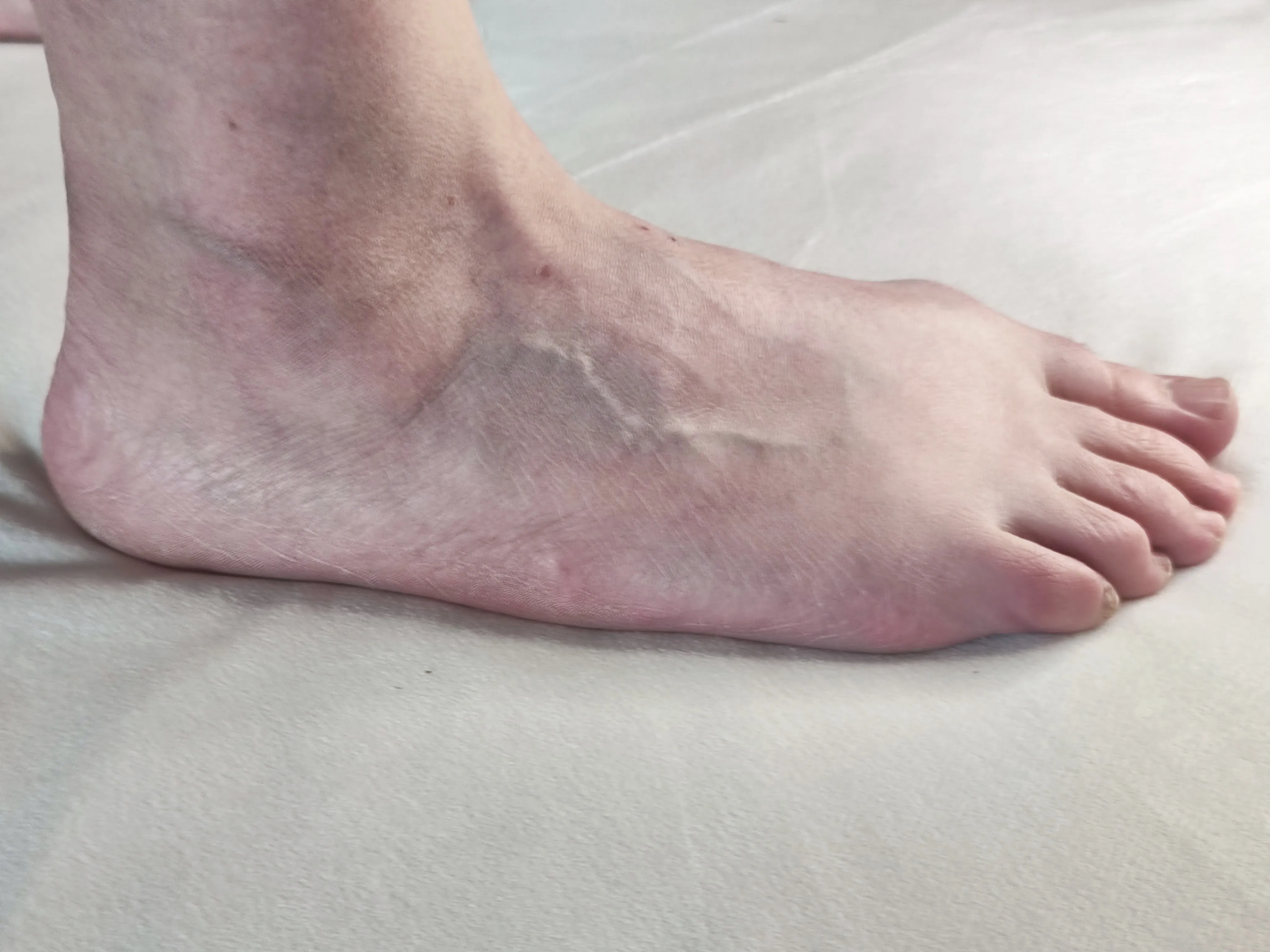 Vue latérale interne