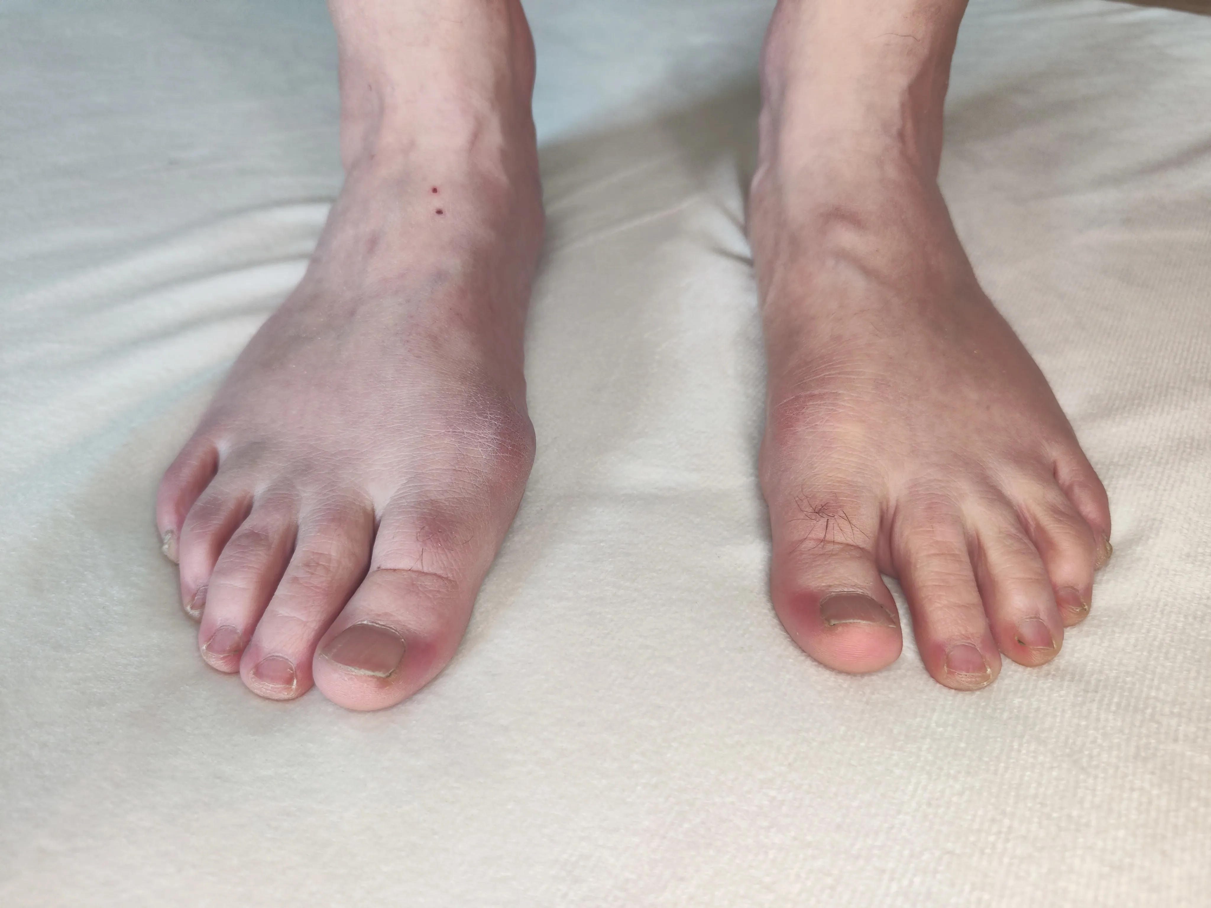 Vue dorsale des pieds